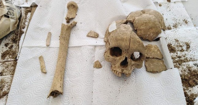 3,500-year-old skull and femur found in Hittite city of Sapinuwa in…