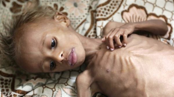 UNICEF says 12M Yemeni children need urgent help
